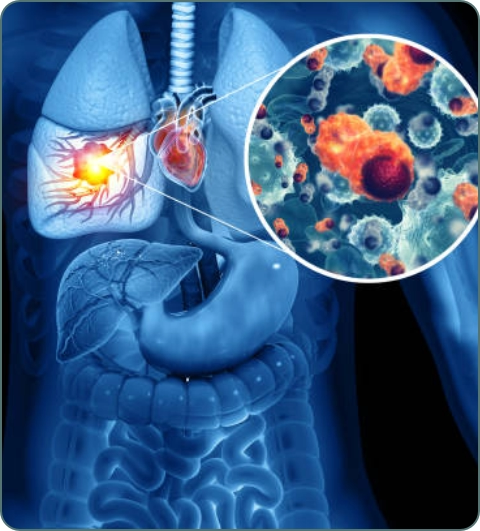 Cancer and oncology illustration