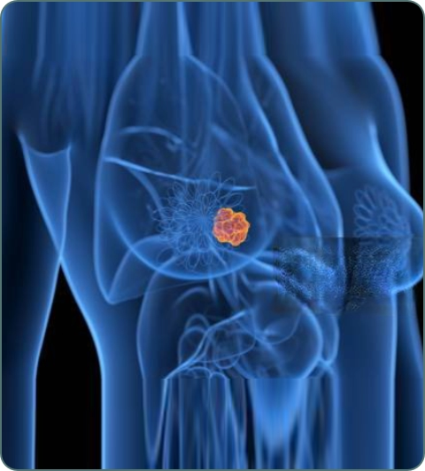 Surgical oncology and cancer surgery illustration