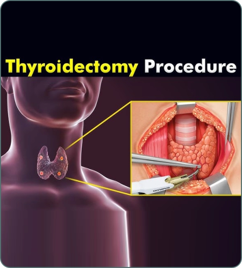 Surgical oncology treatments and procedures imagery