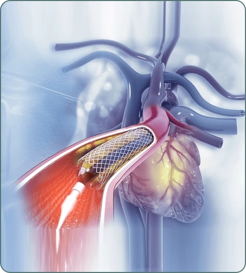 Cardiac treatments and procedures imagery