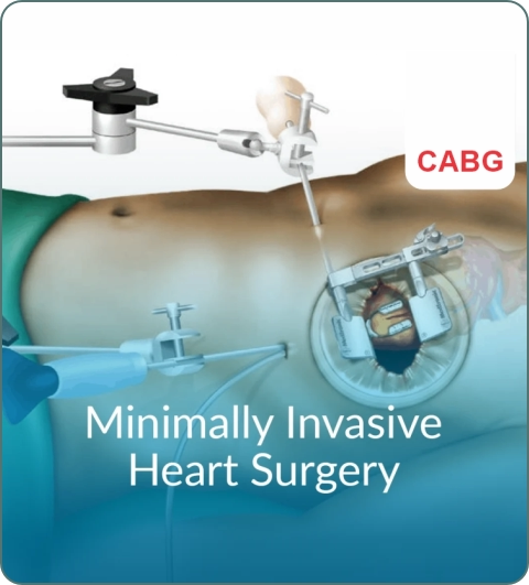 CTVS treatments and procedures imagery